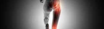 Sciatica