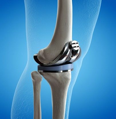 Fisioterapia protesi ginocchio